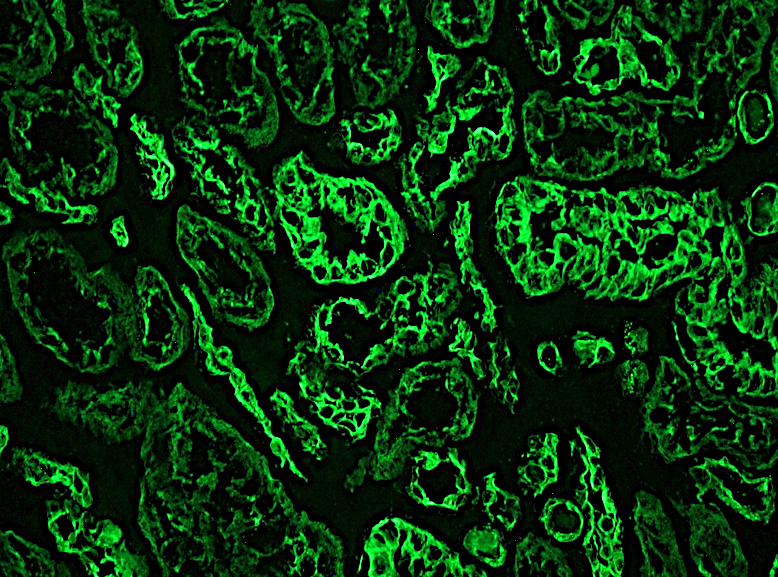 Figure 1. Indirect immunofluorescence staining of frozen section of human kidney with MUB0327P (RCK106) showing positive staining in epithelial compartment. Dilution 1:500.